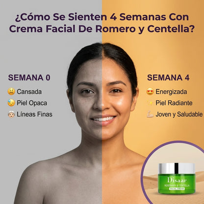 Crema Anti Acné Rosemary ( COMPRA 1 RECIBE 2 )
